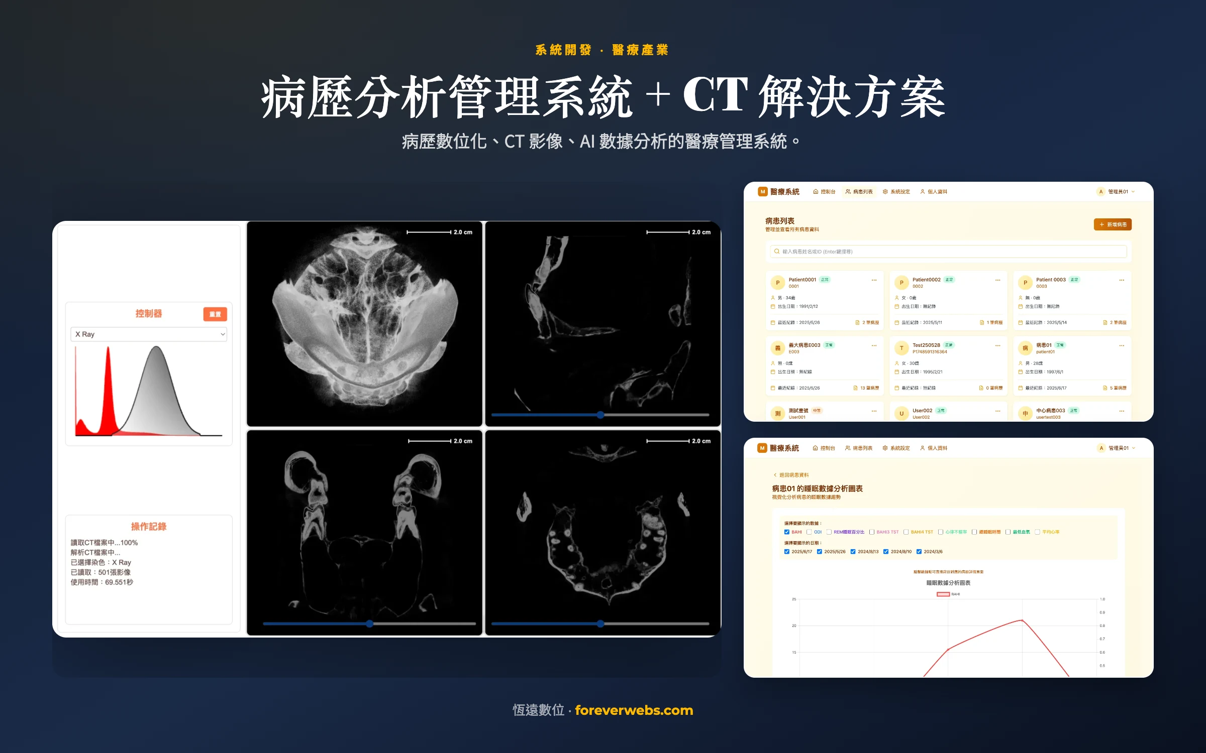病歷分析管理系統 + CT 電腦斷層解決方案